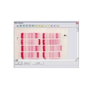 Gel Documentation
